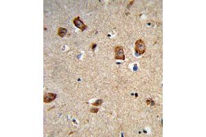 Formalin-fixed and paraffin-embedded human brain tissue reacted with ITGA1 Antibody (Center), which was peroxidase-conjugated to the secondary antibody, followed by DAB staining. (Integrin alpha 1 抗体  (AA 727-755))