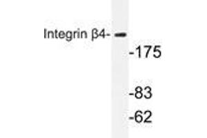 Western blot analysis of Integrin β4 antibody in extracts from HepG2 cells. (Integrin beta 4 抗体)