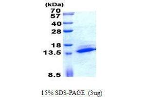 Figure annotation denotes ug of protein loaded and % gel used. (SAMD13 蛋白)