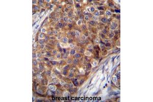Immunohistochemistry (Paraffin-embedded Sections) (IHC (p)) image for anti-Cytochrome C Oxidase Subunit VIIa Polypeptide 2 Like (COX7A2L) (AA 36-65), (Middle Region) antibody (ABIN951673)