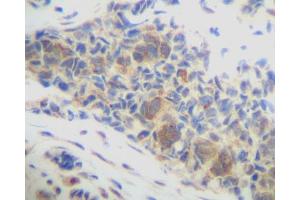 Image no. 3 for anti-Chemokine (C-X-C Motif) Ligand 14 (CXCL14) antibody (ABIN465240) (CXCL14 抗体)