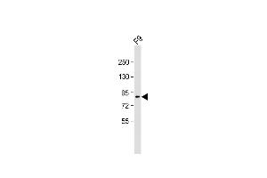 Anti-SUZ12 Antibody (C-term) at 1:2000 dilution + F9 whole cell lysate Lysates/proteins at 20 μg per lane. (SUZ12 抗体  (C-Term))