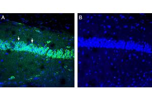 Expression of IGF1 in mouse hippocampus. (IGF1 抗体  (Secreted))