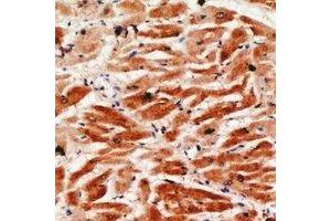 Immunohistochemical analysis of Granzyme A staining in human heart formalin fixed paraffin embedded tissue section. (GZMA 抗体)