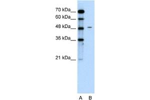 WB Suggested Anti-CHGA Antibody Titration:  0. (Chromogranin A 抗体  (C-Term))