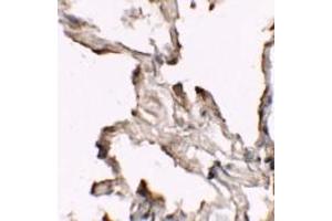 Immunohistochemistry (IHC) image for anti-Nibrin (NBN) (C-Term) antibody (ABIN1030542) (Nibrin 抗体  (C-Term))