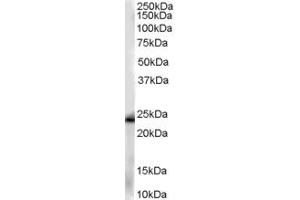 Western Blotting (WB) image for anti-Chromosome 11 Open Reading Frame 82 (C11orf82) (C-Term) antibody (ABIN2789390) (C11orf82 抗体  (C-Term))