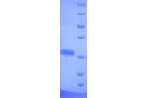PtxA Gene Product (PTXA) (AA 35-269), (full length) protein (His tag)