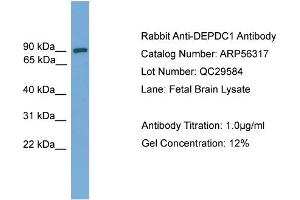 WB Suggested Anti-DEPDC1  Antibody Titration: 0. (DEPDC1 抗体  (Middle Region))
