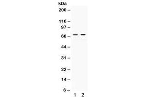 Western blot testing of 1) rat kidney and 2) human HeLa lysate with c-Rel antibody. (c-Rel 抗体)