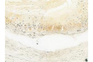 ABIN6264005 and ABIN6279673 at 1/100 staining human testicular cancer by IHC-P.
