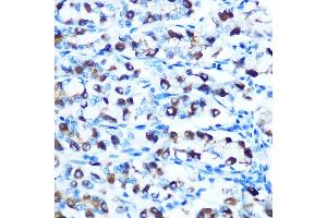 Immunohistochemistry (IHC) image for anti-Solute Carrier Family 11 (Proton-Coupled Divalent Metal Ion Transporters), Member 2 (SLC11A2) (AA 1-100) antibody (ABIN6147839)