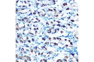 Immunohistochemistry of paraffin-embedded rat stomach using DMT1 Rabbit pAb (ABIN6129471, ABIN6147839, ABIN6147840 and ABIN6214400) at dilution of 1:100 (40x lens). (SLC11A2 抗体  (AA 1-100))