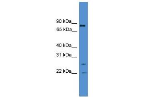 WB Suggested Anti-AKAP8L Antibody Titration:  0. (AKAP8L 抗体  (Middle Region))