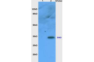 Lane 1: mouse liver lysates Lane 2: mouse thymus lysates probed with Anti CD1A Polyclonal Antibody, Unconjugated (ABIN1386771) at 1:200 in 4 °C. (CD1d1 抗体  (AA 165-270))