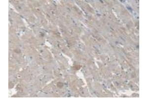 Immunohistochemistry (IHC) image for anti-Carboxylesterase 1 (CES1) (AA 19-300) antibody (ABIN7434857)