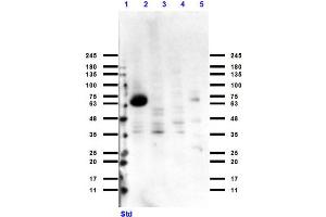 Western Blotting (WB) image for anti-Cytochrome P450, Family 1, Subfamily A, Polypeptide 1 (CYP1A1) antibody (ABIN6657370)