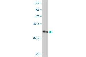 Western Blot detection against Immunogen (38. (HARS2 抗体  (AA 2-110))