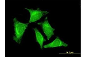 Immunofluorescence of monoclonal antibody to RASGEF1C on HeLa cell. (RASGEF1C 抗体  (AA 168-260))