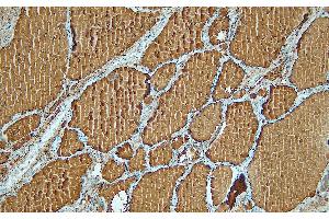 Immunohistochemistry (IHC) image for anti-Thyroglobulin (TG) (C-Term) antibody (ABIN7598886) (Thyroglobulin 抗体  (C-Term))