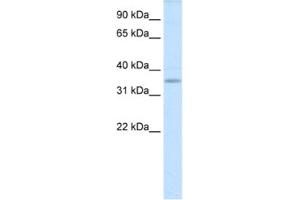 Western Blotting (WB) image for anti-TGFB-Induced Factor Homeobox 2-Like, X-Linked (TGIF2LX) antibody (ABIN2461543) (TGIF2LX 抗体)