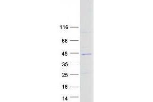 Western Blotting (WB) image for Sorting Nexin 20 (SNX20) (Transcript Variant 1) protein (Myc-DYKDDDDK Tag) (ABIN2732401)