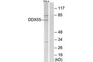 Western blot analysis of extracts from HeLa cells, using DDX55 Antibody. (DDX55 抗体  (AA 91-140))