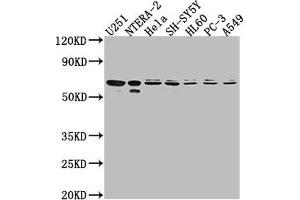 Western Blot Positive WB detected in: U251 whole cell lysate, NTERA-2 whole cell lysate, Hela whole cell lysate, SH-SY5Y whole cell lysate, HL60 whole cell lysate, PC-3 whole cell lysate, A549 whole cell lysate All lanes: CDK17 antibody at 1:2000 Secondary Goat polyclonal to rabbit IgG at 1/50000 dilution Predicted band size: 60 kDa Observed band size: 60 kDa (CDK17 抗体  (AA 337-523))