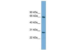 Western Blot showing FBXW8 antibody used at a concentration of 1-2 ug/ml to detect its target protein. (FBXW8 抗体  (Middle Region))