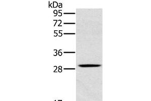 Western Blot analysis of Human testis tissue using CLIC1 Polyclonal Antibody at dilution of 1:400 (CLIC1 抗体)