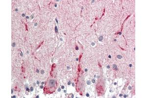 Immunohistochemistry (IHC) image for anti-gamma-aminobutyric Acid (GABA) A Receptor, gamma 2 (GABRG2) (AA 61-110) antibody (ABIN6755272)