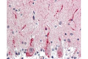 Anti-GABRG2 antibody IHC staining of human brain, cerebellum. (GABRG2 抗体  (AA 61-110))