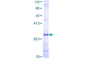 C5AR1 Protein (AA 241-350) (GST tag)