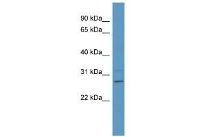 WB Suggested Anti-PSPH Antibody Titration: 0. (PSPH 抗体  (Middle Region))