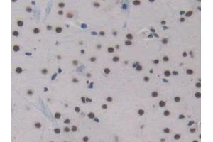 Detection of ENG in Mouse Cerebrum Tissue using Polyclonal Antibody to Endoglin (ENG) (Endoglin 抗体  (AA 27-137))