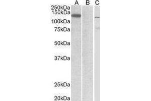 Western Blotting (WB) image for anti-Mindbomb E3 Ubiquitin Protein Ligase 1 (MIB1) (Internal Region) antibody (ABIN2475692)