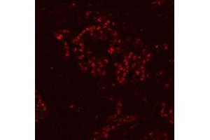 IF analysis of HnRNP H/HNRNPH1 using anti-HnRNP H/HNRNPH1 antibody (ABIN4886623). (HNRNPH1 抗体  (N-Term))