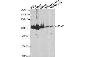 Western blot analysis of extracts of various cell lines, using MCM5 antibody (ABIN5973237) at 1:3000 dilution. (MCM5 抗体)