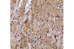 IHC analysis of DOK7 using anti-DOK7 antibody (ABIN6719428).