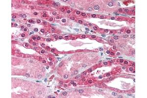 Image no. 1 for anti-Solute Carrier Family 2 (Facilitated Glucose Transporter), Member 10 (SLC2A10) (AA 367-385) antibody (ABIN302965)