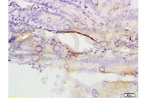 Immunohistochemistry (IHC) image for anti-Excision Repair Cross Complementing Polypeptide-1 (ERCC1) (AA 151-250) antibody (ABIN733553)