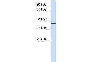 WB Suggested Anti-LHX8 Antibody Titration:  0. (LHX8 抗体  (Middle Region))