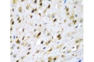 Immunohistochemistry of paraffin-embedded Mouse brain using TPH2 Polyclonal Antibody at dilution of 1:200 (40x lens). (Tryptophan Hydroxylase 2 抗体)