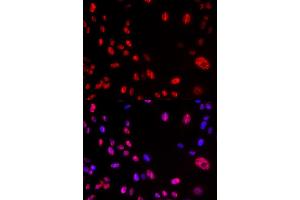 Immunofluorescence analysis of U2OS cells using Phospho-ATM-S1981 antibody (ABIN5969871). (ATM 抗体  (pSer1981))