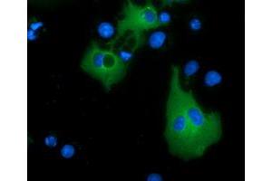 Immunofluorescence (IF) image for anti-Myotubularin Related Protein 14 (MTMR14) antibody (ABIN1499587) (MTMR14 抗体)