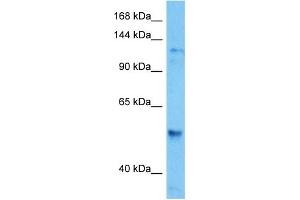 Host:  Mouse  Target Name:  HDAC6  Sample Tissue:  Mouse Spleen  Antibody Dilution:  1ug/ml (HDAC6 抗体  (C-Term))