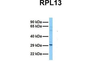 Host:  Rabbit  Target Name:  RPL13  Sample Tissue:  Human Fetal Lung  Antibody Dilution:  1. (RPL13 抗体  (C-Term))