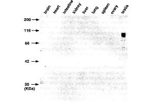Western Blotting (WB) image for anti-Gena antibody (ABIN3201020) (Gena 抗体)