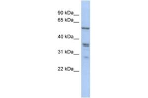 Western Blotting (WB) image for anti-Solute Carrier Family 38, Member 2 (SLC38A2) antibody (ABIN2463893) (SLC38A2 抗体)