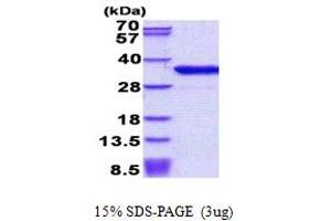 SDS-PAGE (SDS) image for Dickkopf Homolog 1 (DKK1) (AA 32-266) protein (His tag) (ABIN5852946)